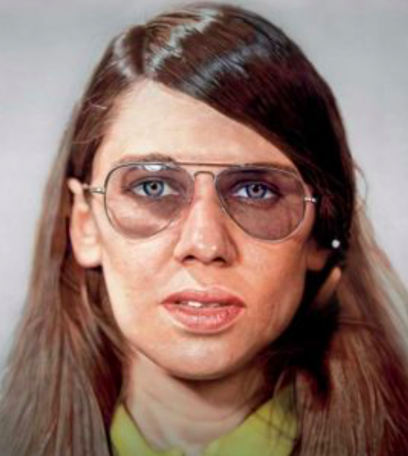 Figure 18. “Susan” by Chuck Close. 1971. Museum of Contemporary Art Chicago.